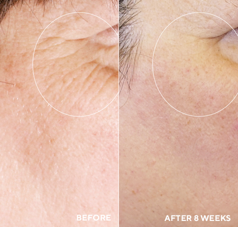 HydroPeptide Daily Drench Before and After